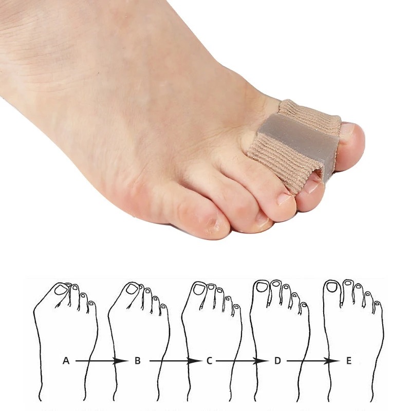4 szt. Silikonowe separatory p – Yoga Toe Separator recenzja i cena